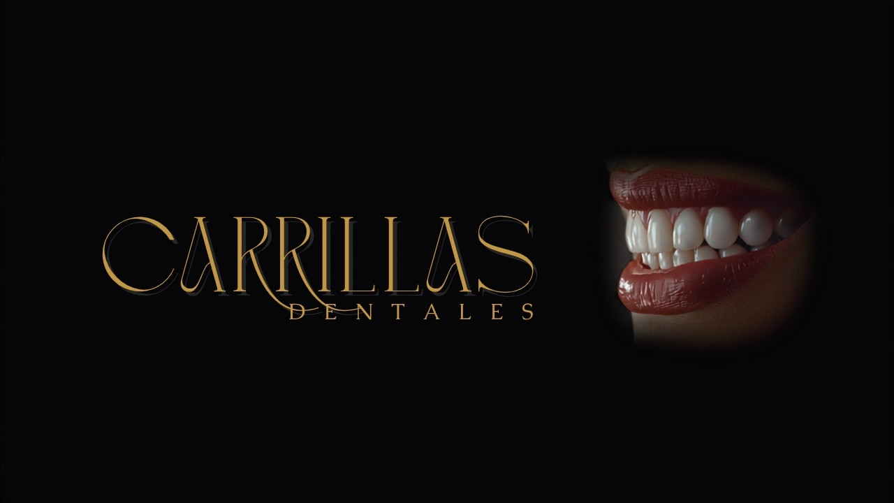 Carillas dentales: todo lo que debes saber